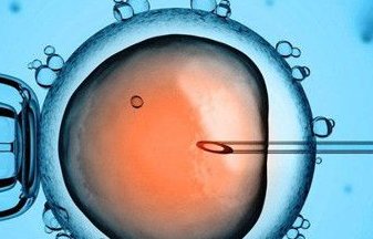 艾滋病试管婴儿是怎样的(艾滋病洗精试管婴儿多少钱)