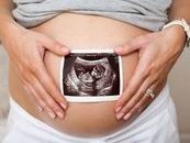 东莞哪家医院可以做特需三代试管？